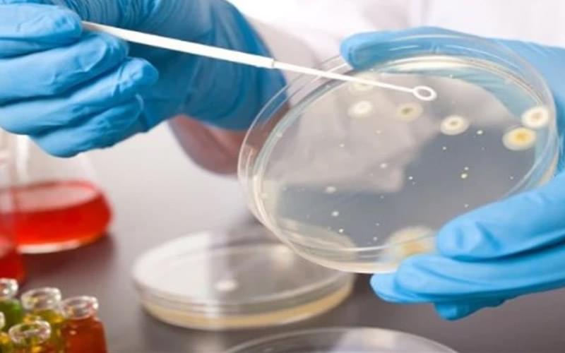 Análise de Esporos Bactérias Aeróbios